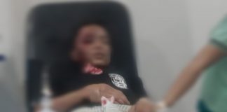 Hindari Kuncing, Mobil Tabrak Pemotor, Korban Alami Luka Serius