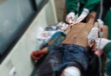 Gunakan Sajam, Dua Kelompok Saling Serang di Pontianak Timur, Tiga Orang Jadi Korban