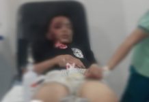 Hindari Kuncing, Mobil Tabrak Pemotor, Korban Alami Luka Serius